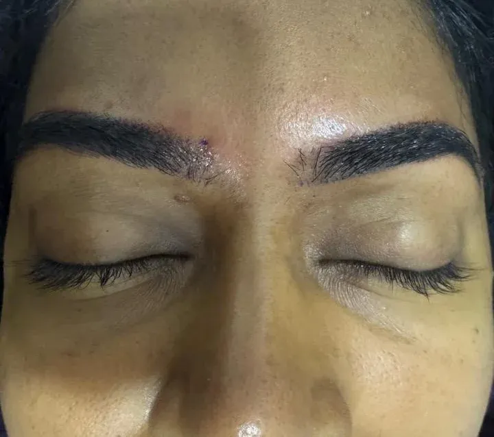 After: eyebrows of a client with closed eyes, before and after a semi-permanent brow treatment