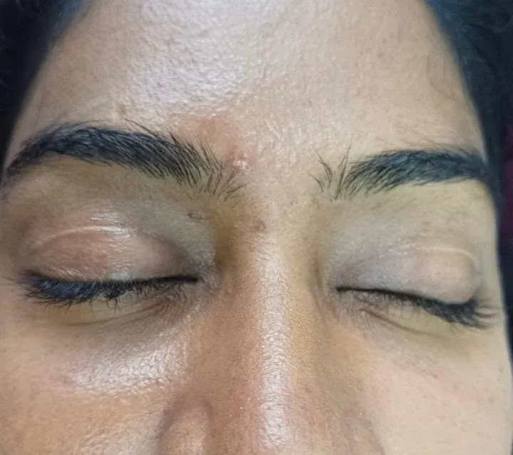 Before: eyebrows of a client with closed eyes, before and after a semi-permanent brow treatment
