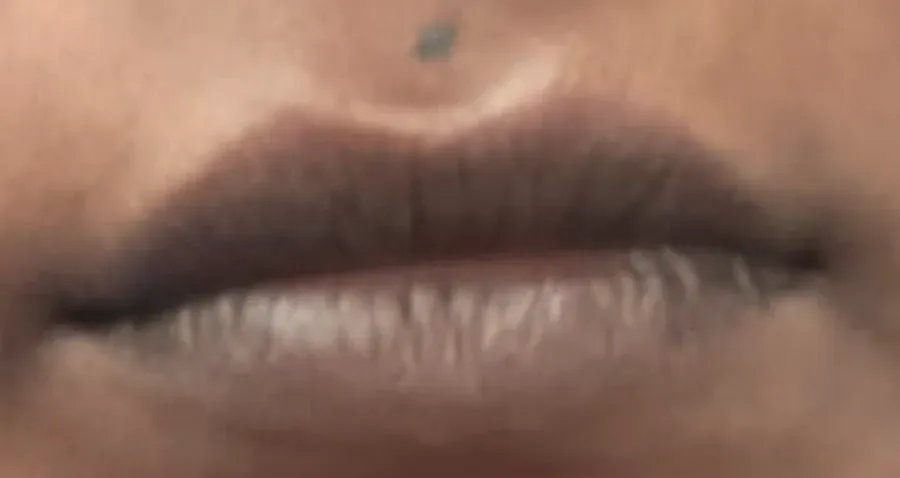 Before: a client's lips, darker before treatment and more even in tone after